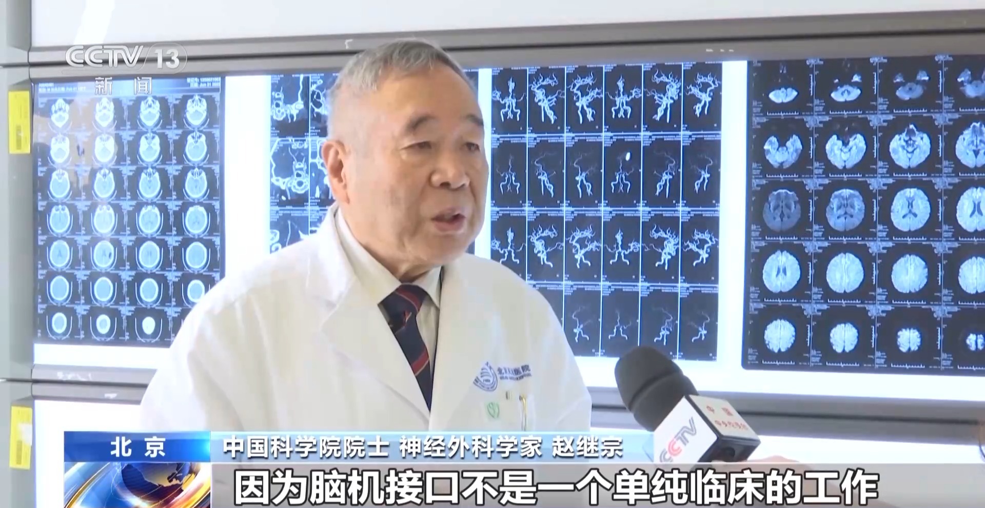 可以看手术视频的网站_脑机接口手术_北京天坛医院脑机接口病房