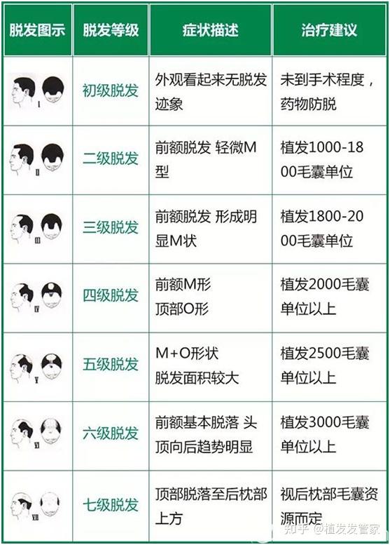发型屋免费在线发型设计软件_M型脱发_M型脱发治疗